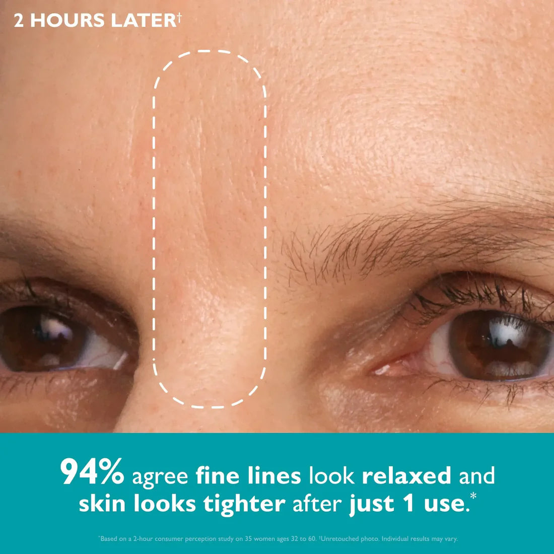 Peptide Face & Eye Tape-Instant Firming | Anti-Wrinkle | Skin Tightening Patches